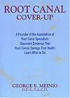 Root Canal Cover Up