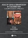 Atlas of Clinical Dermatology in Coloured Skin: A Morphological Approach