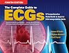 The complete guide to ECGs