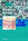 Alopecia Areata (Genetic Diseases)