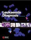 Leukaemia Diagnosis