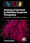 Anatomy of the Heart by Multislice Computed Tomography