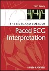 The Nuts and bolts of Paced ECG Interpretation