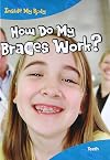 How Do Braces Work? (Inside My Body: Teeth)