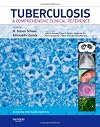 Tuberculosis: A Comprehensive Clinical Reference