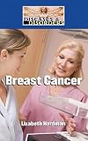 Breast Cancer