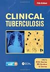 Clinical Tuberculosis, Fifth Edition