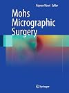 Mohs Micrographic Surgery