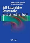 Self-expandable stents in the gastrointestinal tract