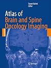 Atlas of Brain and Spine Oncology Imaging (Atlas of Oncology Imaging)