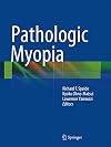 Pathologic Myopia