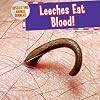 Leeches Eat Blood! (Disgusting Animal Dinners)