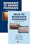Mild to Moderate and Moderate to Severe Psoriasis (Set)