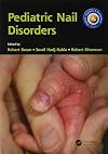 Pediatric nail disorders