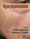 Hyperpigmentation