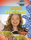 Down Syndrome (Genetic Diseases and Gene Therapies)