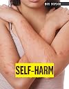 Self-harm