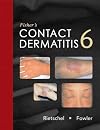 Fisher's Contact Dermatitis