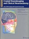 Cranial Neuroimaging and Clinical Neuroanatomy: Magnetic Resonance Imaging andComputed Tomography (Thieme Classics)