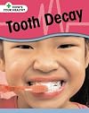 Tooth Decay (How's Your Health?)