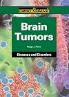 Brain Tumors (Compact Research: Diseases and Disorders)