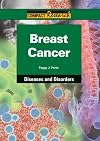 Breast Cancer (Compact Research: Diseases and Disorders)