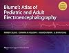 Blume's Atlas of Pediatric and Adult Electroencephalography