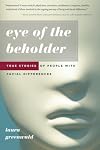 Eye of the Beholder: True Stories of People with Facial Differences