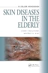 Skin Diseases in the Elderly: A Color Handbook (Medical Color Handbook Series)