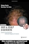 Hair and Scalp Disorders