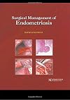 Surgical Management of Endometriosis