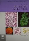 An Atlas of Diabetes Mellitus, Second Edition (The Encyclopedia of Visual Medicine Series)