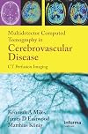Multidetector Computed Tomography in Cerebrovascular Disease: CT Perfusion Imaging