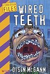Wired Teeth
