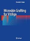 Microskin Grafting for Vitiligo