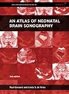 An atlas of neonatal brain sonography
