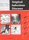 Tropical Infectious Diseases: Epidemiology, Investigation, Diagnosis and Management