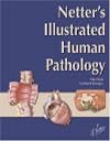 Netter's illustrated human pathology