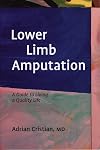 Lower Limb Amputation: A Guide to Living a Quality Life
