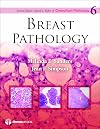 Breast Pathology (Consultant Pathology, Volume 6)