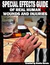 Special Effects Guide Of Real Human Wounds and Injuries: Special Effects Guide Of Real Human Wounds and Injuries