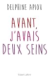 Avant, j'avais deux seins