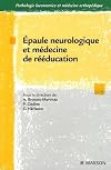 Cervicoscapulalgies professionnelles