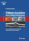 Oedèmes maculaires : aspects cliniques et thérapeutiques
