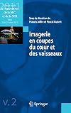 Imagerie en coupes du cœur et des vaisseaux Compte rendu des 4es rencontres de la SFC et de la SFR : Paris, 24 et 25 mars 2011