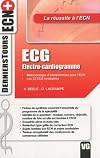 ECG électro-cardiogramme