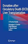Donation after Circulatory Death (DCD) Liver Transplantation: A Practical Guide
