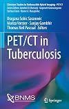 PET/CT in Tuberculosis (Cliniciansβ Guides to Radionuclide Hybrid Imaging)