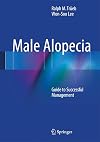 Male Alopecia: Guide to Successful Management