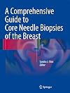 A Comprehensive Guide to Core Needle Biopsies of the Breast